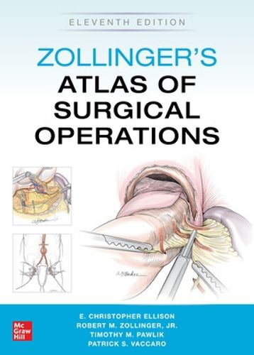 Cover image for Zollinger's Atlas of Surgical Operations, Eleventh Edition