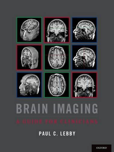 Cover image for Brain Imaging: A Guide for Clinicians