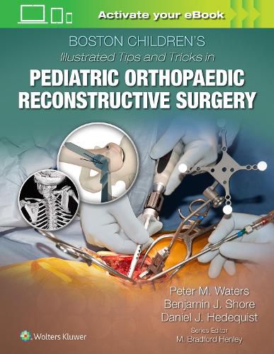 Cover image for Boston Children's Illustrated Tips and Tricks in Pediatric Orthopaedic Reconstructive Surgery