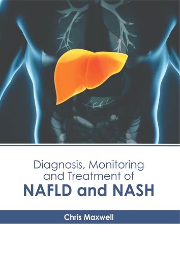 Cover image for Diagnosis, Monitoring and Treatment of Nafld and Nash