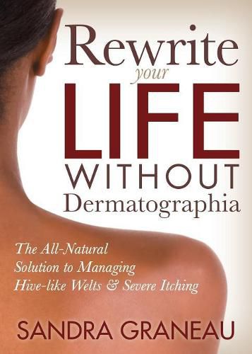 Cover image for Rewrite Your Life Without Dermatographia: The All-Natural Solution to Managing Hive-like Welts and Severe Itching