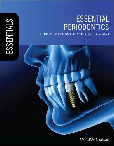 Cover image for Essential Periodontics