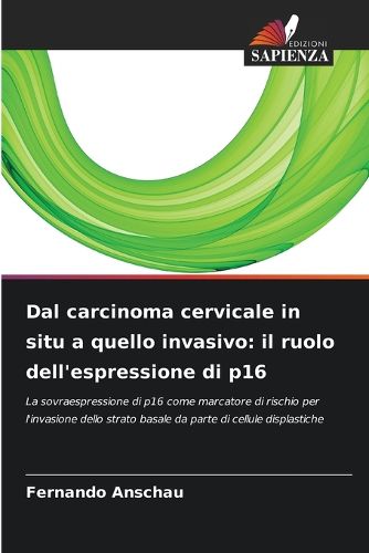 Cover image for Dal carcinoma cervicale in situ a quello invasivo
