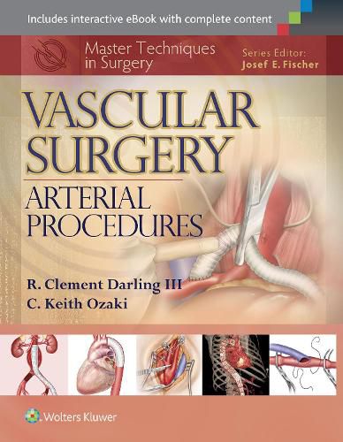 Cover image for Master Techniques in Surgery: Vascular Surgery: Arterial Procedures