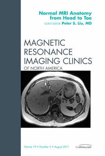 Cover image for Normal MR Anatomy from Head to Toe, An Issue of Magnetic Resonance Imaging Clinics