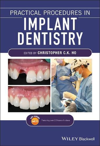 Cover image for Practical Procedures in Implant Dentistry