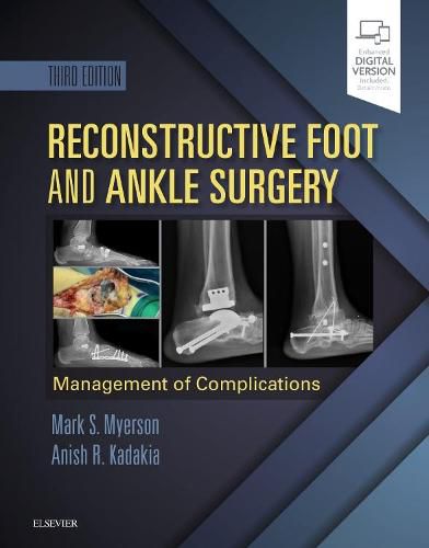 Cover image for Reconstructive Foot and Ankle Surgery: Management of Complications