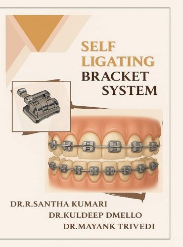 Cover image for Self Ligating Bracket System