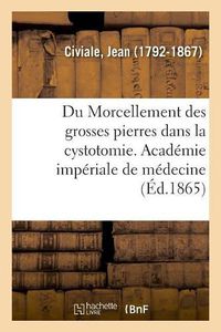 Cover image for Du Morcellement Des Grosses Pierres Dans La Cystotomie. Academie Imperiale de Medecine