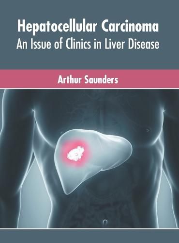 Cover image for Hepatocellular Carcinoma: An Issue of Clinics in Liver Disease