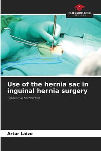 Cover image for Use of the hernia sac in inguinal hernia surgery