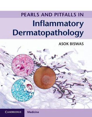 Cover image for Pearls and Pitfalls in Inflammatory Dermatopathology