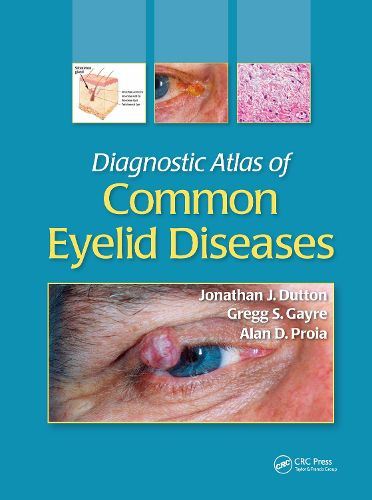 Cover image for Diagnostic Atlas of Common Eyelid Diseases