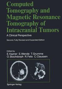 Cover image for Computed Tomography and Magnetic Resonance Tomography of Intracranial Tumors: A Clinical Perspective