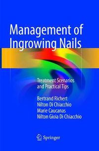 Cover image for Management of Ingrowing Nails: Treatment Scenarios and Practical Tips