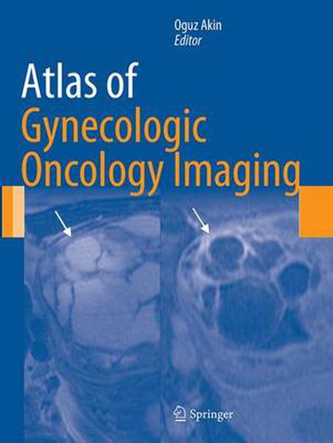 Cover image for Atlas of Gynecologic Oncology Imaging