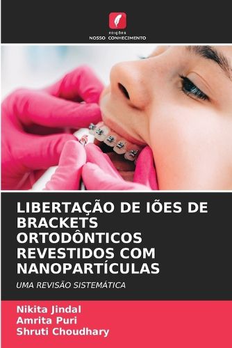 Cover image for Libertacao de Ioes de Brackets Ortodonticos Revestidos Com Nanoparticulas