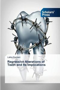 Cover image for Regressive Alterations of Teeth and Its Implications