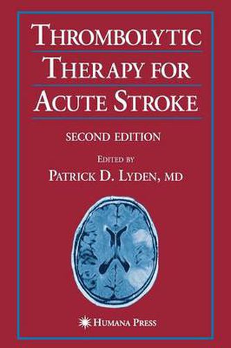 Cover image for Thrombolytic Therapy for Acute Stroke