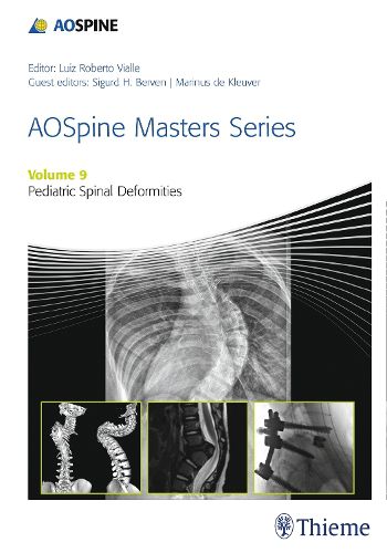 Cover image for AOSpine Masters Series, Volume 9: Pediatric Spinal Deformities