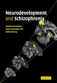 Cover image for Neurodevelopment and Schizophrenia