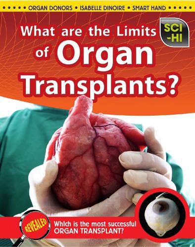Cover image for What Are the Limits of Organ Transplantation?