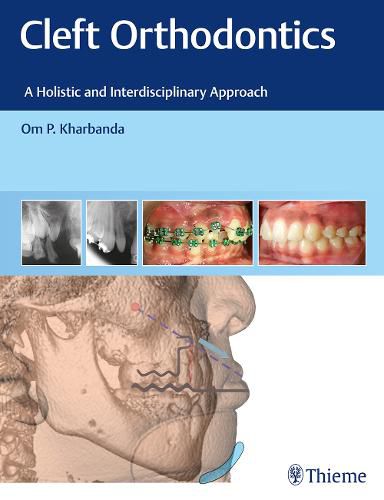 Cover image for Cleft Orthodontics: A Holistic and Interdisciplinary Approach