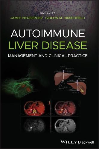 Cover image for Autoimmune Liver Disease - Management and Clinical  Practice