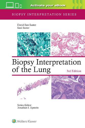 Cover image for Biopsy Interpretation of the Lung