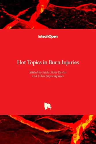 Cover image for Hot Topics in Burn Injuries