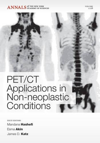 Cover image for PET CT Applications in Non-Neoplastic Conditions