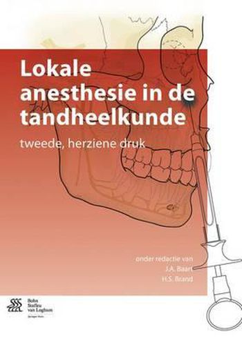 Cover image for Lokale Anesthesie in de Tandheelkunde