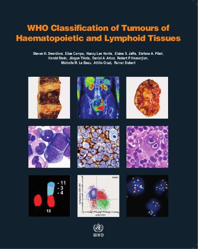 WHO classification of tumours of haematopoietic and lymphoid tissues: Vol. 2