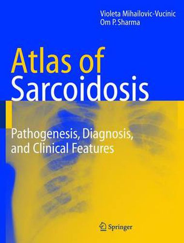 Cover image for Atlas of Sarcoidosis: Pathogenesis, Diagnosis and Clinical Features