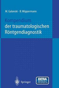 Cover image for Kompendium der traumatologischen Roentgendiagnostik