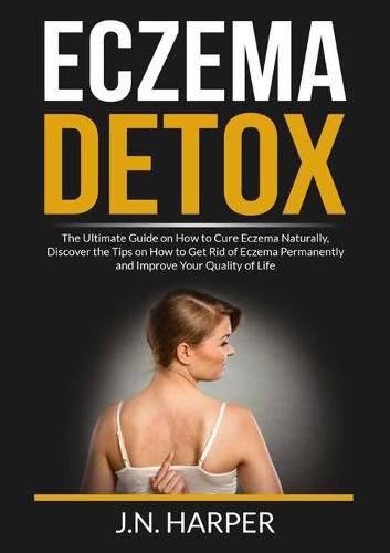 Cover image for Eczema Detox: The Ultimate Guide on How to Cure Eczema Naturally, Discover the Tips on How to Get Rid of Eczema Permanently and Improve Your Quality of Life