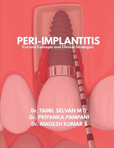Cover image for Peri-Implantitis