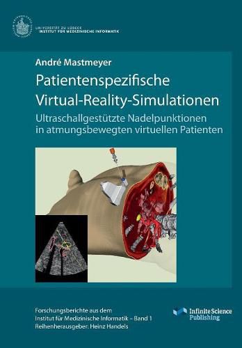 Cover image for Patientenspezifische Virtual-Reality-Simulationen