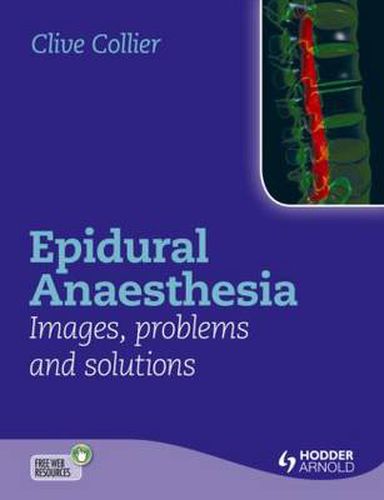 Cover image for Epidural Anaesthesia: Images, Problems and Solutions
