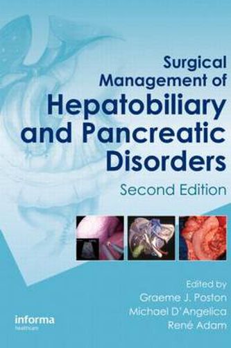 Cover image for Surgical Management of Hepatobiliary and Pancreatic Disorders, Second Edition