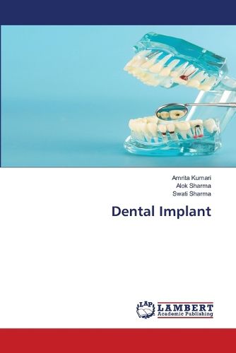 Cover image for Dental Implant