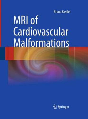 Cover image for MRI of Cardiovascular Malformations