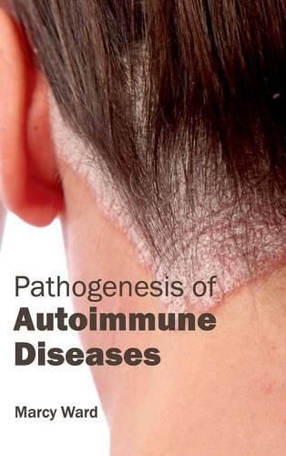 Cover image for Pathogenesis of Autoimmune Diseases