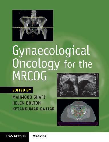 Cover image for Gynaecological Oncology for the MRCOG