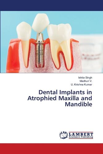 Cover image for Dental Implants in Atrophied Maxilla and Mandible
