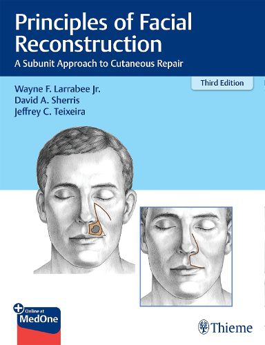 Cover image for Principles of Facial Reconstruction: A Subunit Approach to Cutaneous Repair