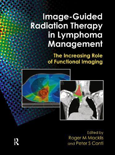 Cover image for Image-Guided Radiation Therapy in Lymphoma Management: The Increasing Role of Functional Imaging