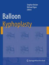 Cover image for Balloon Kyphoplasty