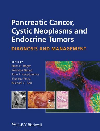 Cover image for Pancreatic Cancer, Cystic Neoplasms and Endocrine Tumors: Diagnosis and Management