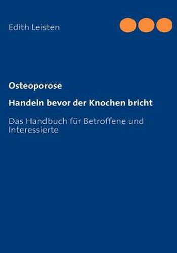 Cover image for Osteoporose: Handeln bevor der Knochen bricht